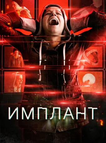 Имплант 2021